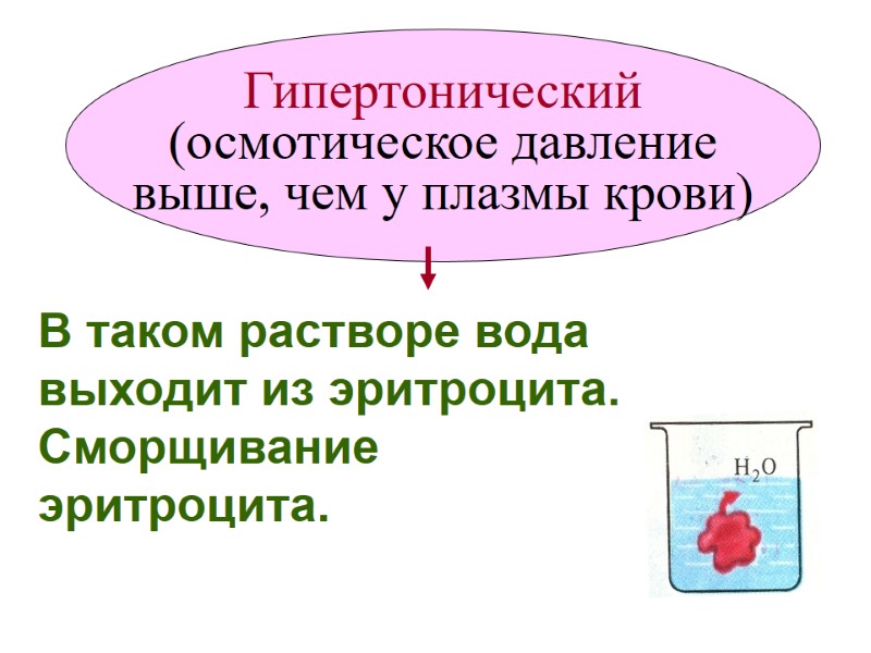 Гипертонический  (осмотическое давление  выше, чем у плазмы крови) В таком растворе вода